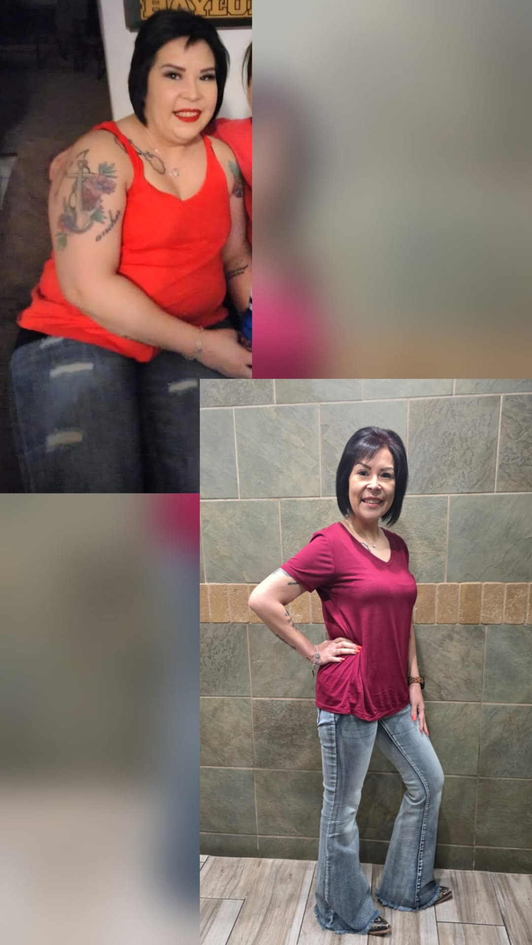Real patient before and after photos following medically supervised weight loss