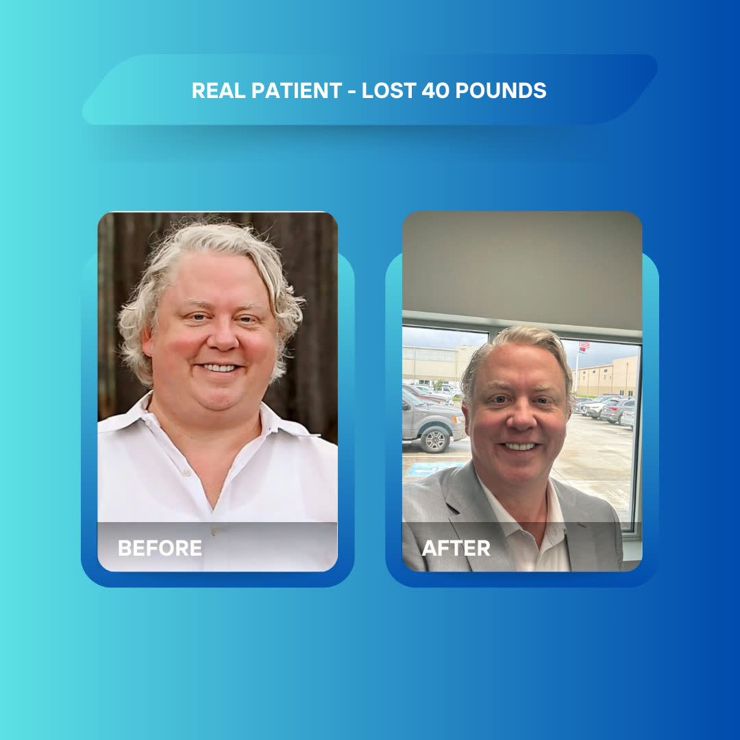 Real patient before and after losing 40 pounds